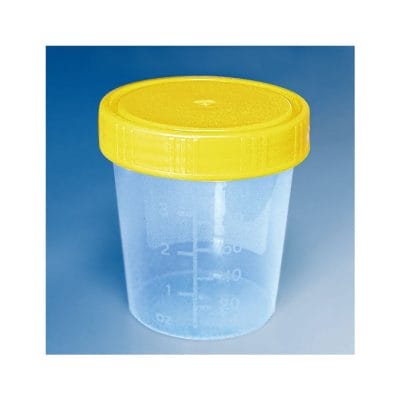 Urinbecher 100 ml mit Schraubdeckel gelb montiert, bestrahlt (5 Stck.)