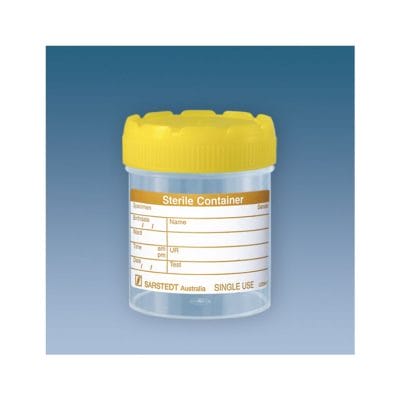 Mehrzweck-Becher 70 ml mit montiertem Schraubverschluss gelb (200 Stck.)